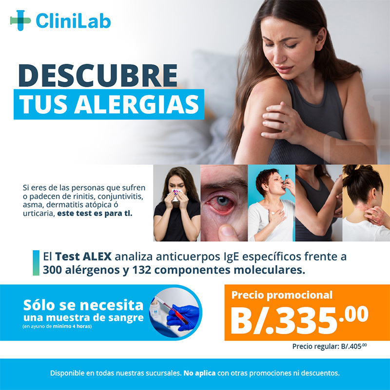TEST DE ALEX (Alergias)